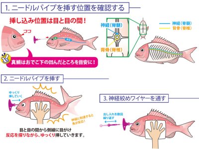 画像3: ルミカ(LUMICA)☆神経絞めセット SUPER LONG A20277【送料590円 8千円以上送料無料】